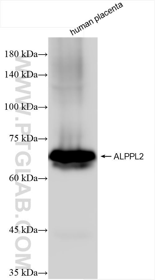 Western Blot (WB) analysis of human placenta tissue using ALPPL2 Recombinant antibody (84813-1-RR)