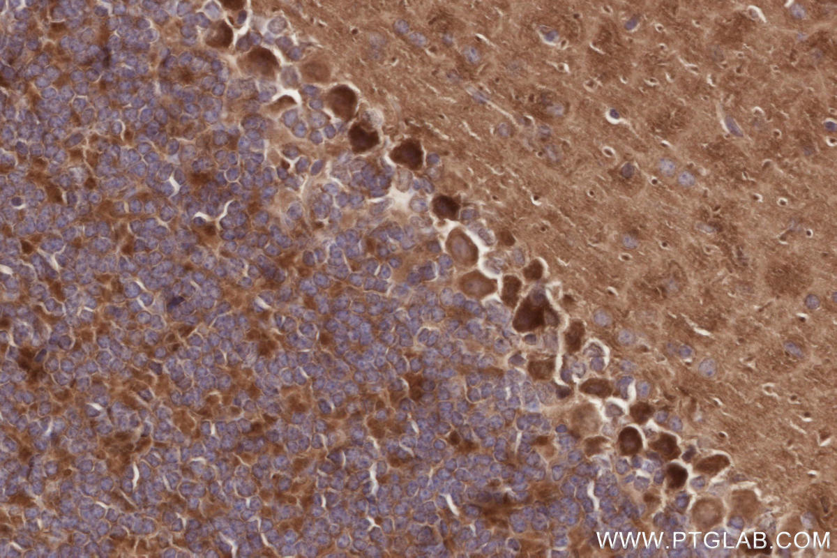 Immunohistochemistry (IHC) staining of mouse cerebellum tissue using ALS2 Polyclonal antibody (13998-1-AP)