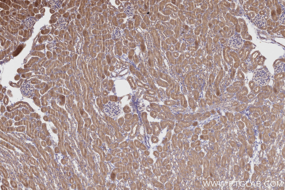 Immunohistochemistry (IHC) staining of mouse kidney tissue using ALS2 Polyclonal antibody (13998-1-AP)