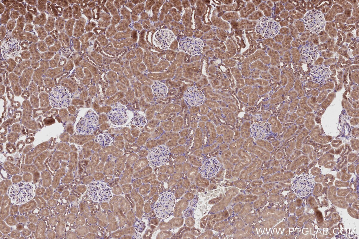 Immunohistochemistry (IHC) staining of rat kidney tissue using ALS2 Polyclonal antibody (13998-1-AP)