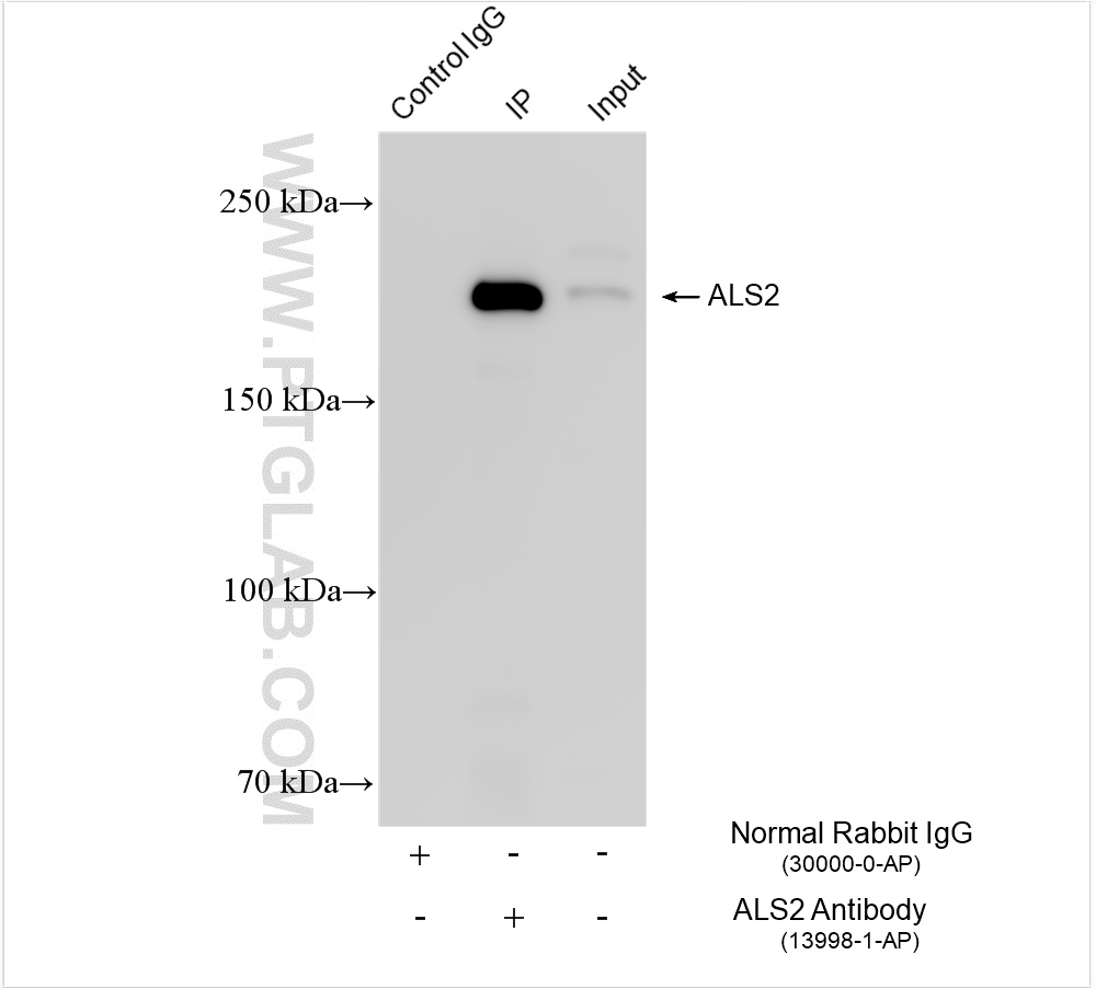 Immunoprecipitation (IP) experiment of HEK-293 cells using ALS2 Polyclonal antibody (13998-1-AP)