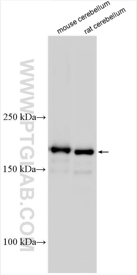 Western Blot (WB) analysis of various lysates using ALS2 Polyclonal antibody (13998-1-AP)