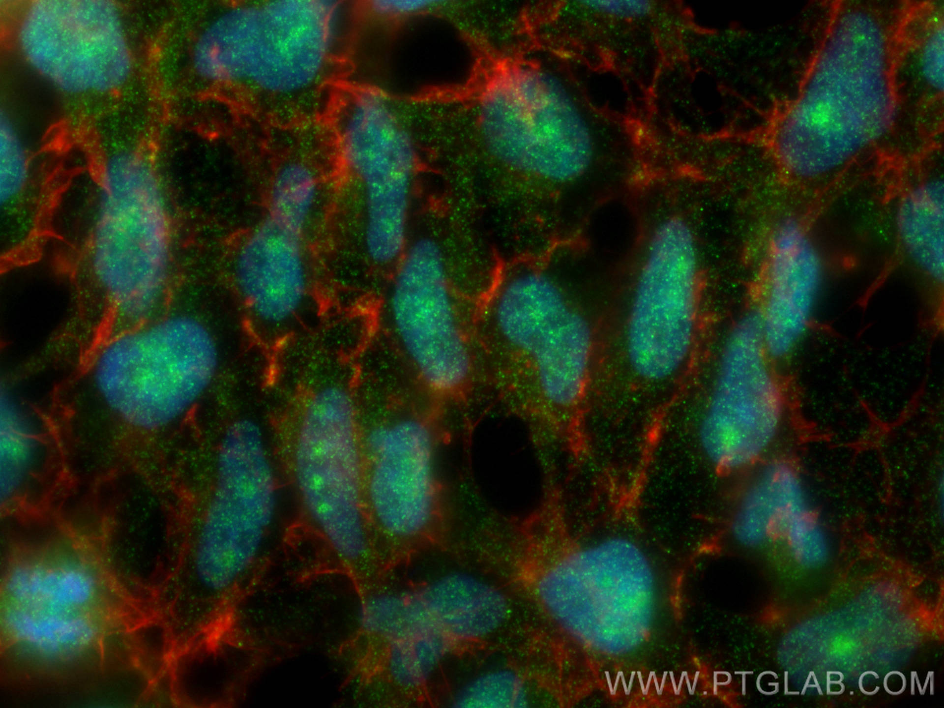 Immunofluorescence (IF) / fluorescent staining of HEK-293 cells using AMBN Polyclonal antibody (26501-1-AP)