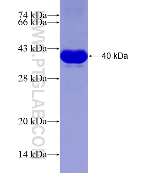 AMER1 fusion protein Ag29093 SDS-PAGE