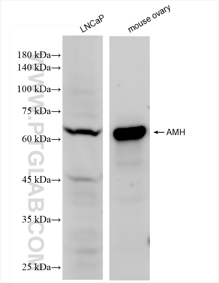 Western Blot (WB) analysis of various lysates using AMH Recombinant antibody (84153-5-RR)