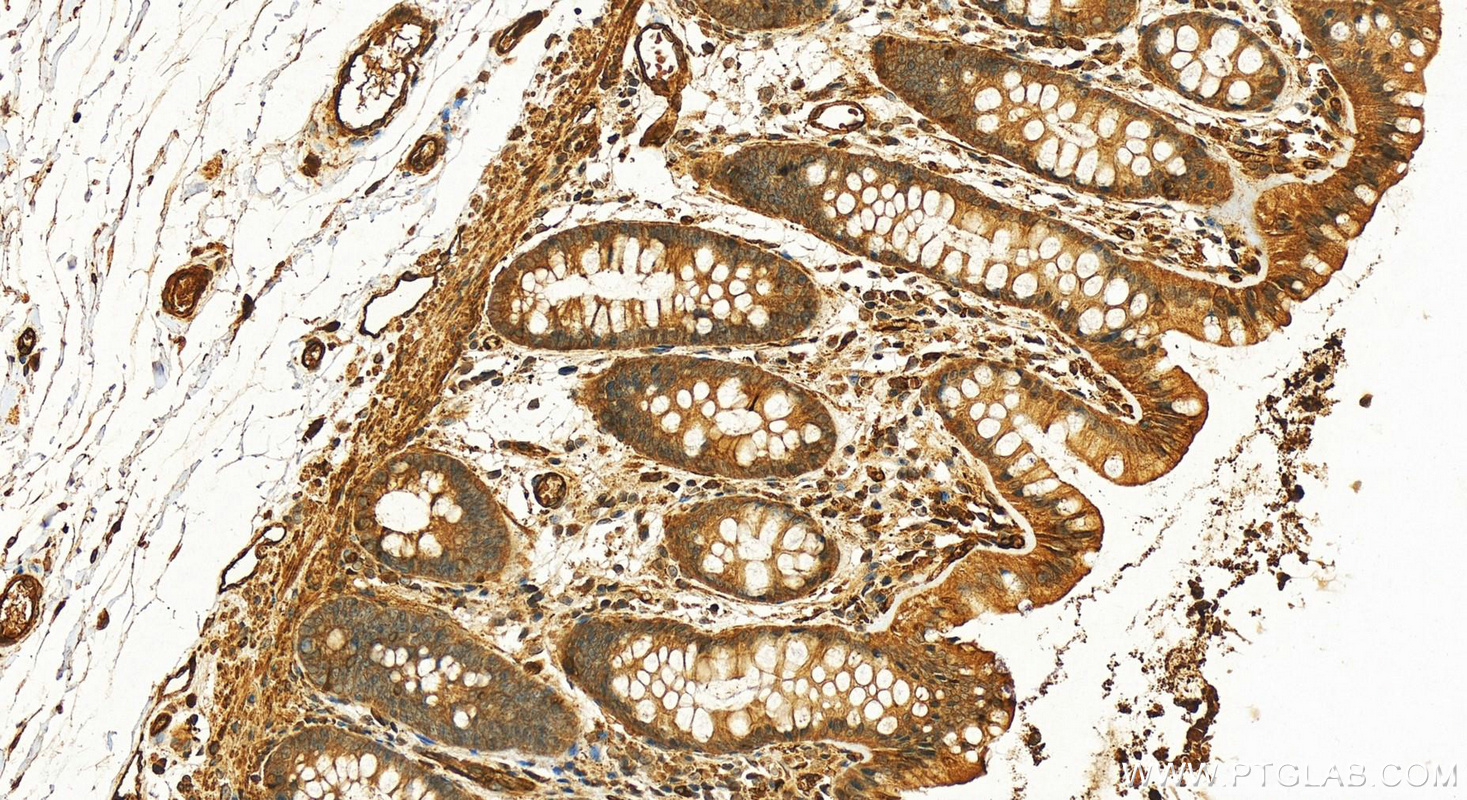 Immunohistochemistry (IHC) staining of human colon tissue using AMPD3 Polyclonal antibody (23997-1-AP)