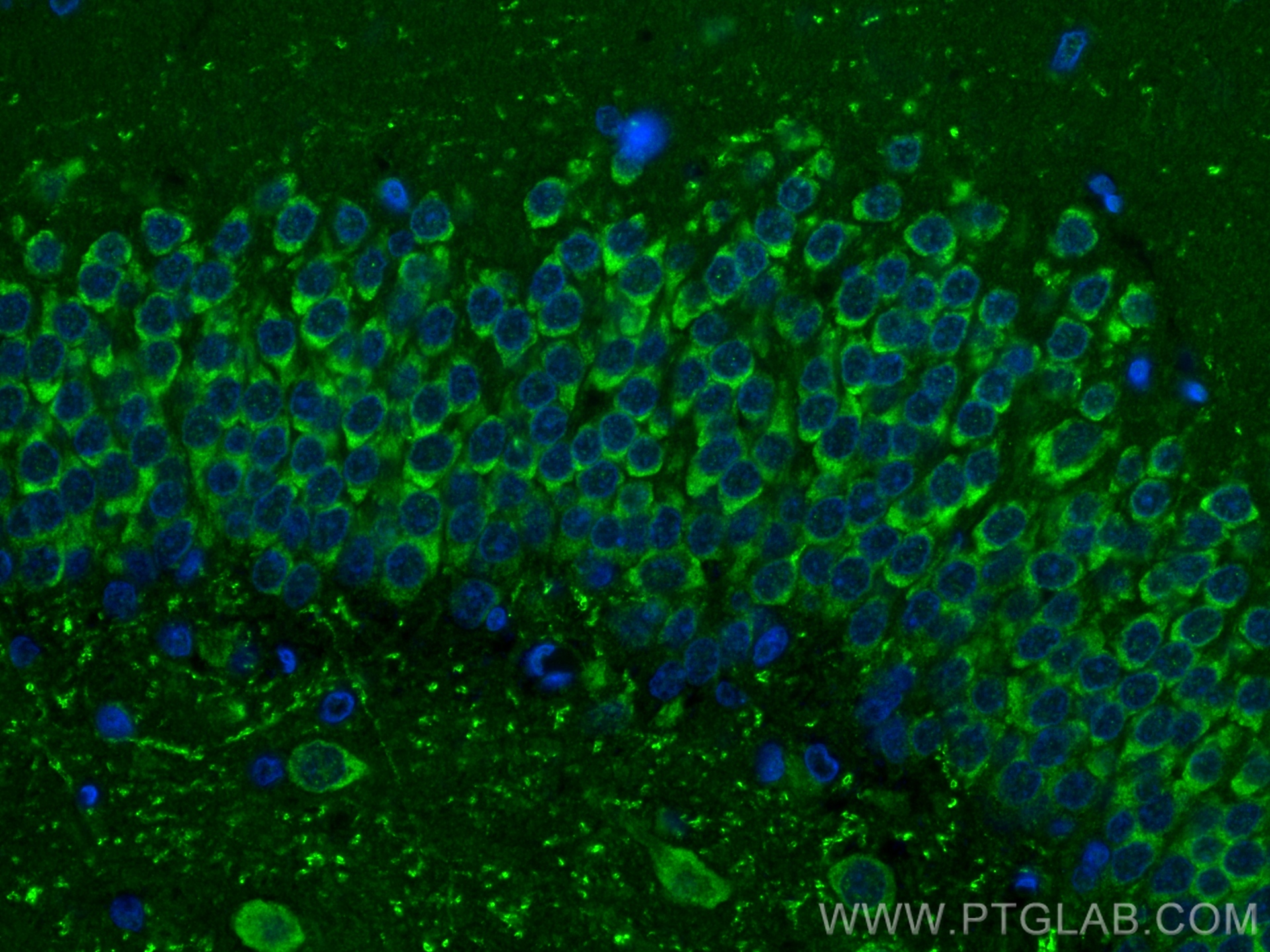 Immunofluorescence (IF) / fluorescent staining of rat brain tissue using AMPK Alpha Recombinant antibody (80209-5-RR)