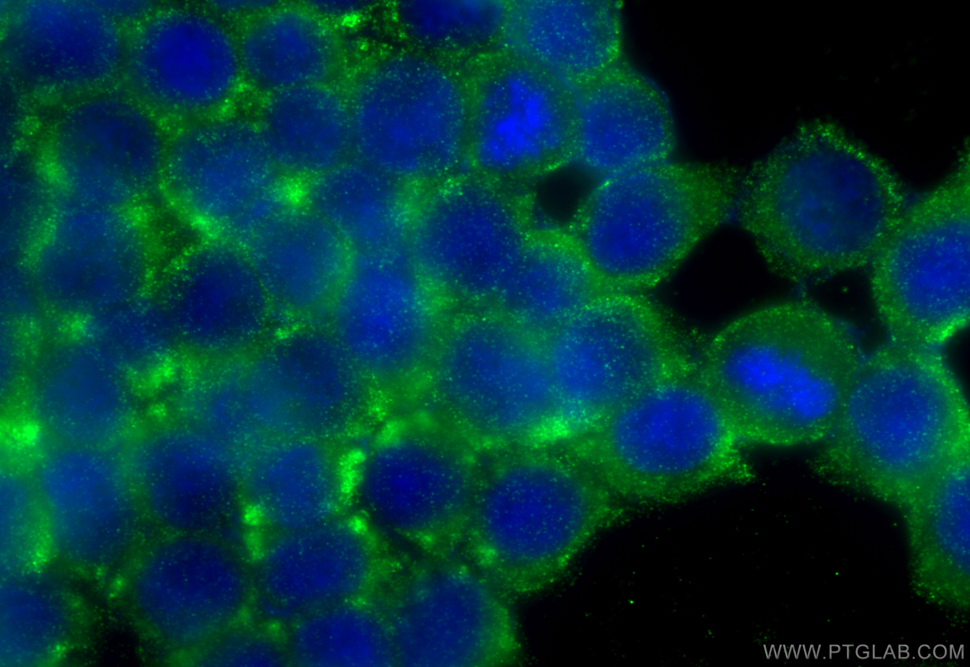 Immunofluorescence (IF) / fluorescent staining of BxPC-3 cells using Amylase Alpha Monoclonal antibody (66133-1-Ig)