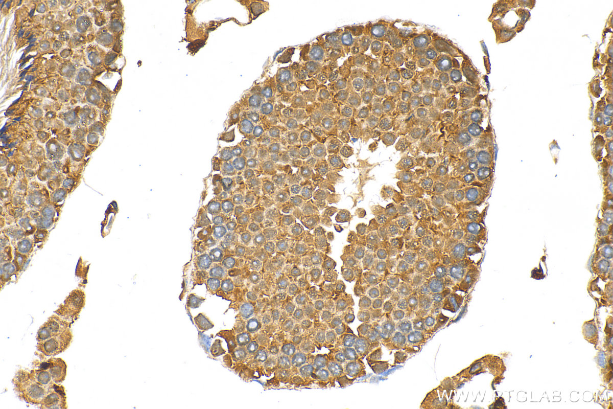 Immunohistochemistry (IHC) staining of mouse testis tissue using APC1 Polyclonal antibody (21748-1-AP)