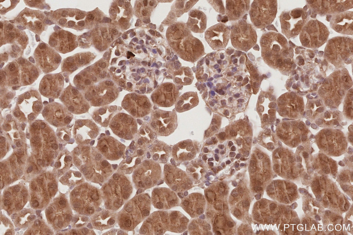 Immunohistochemistry (IHC) staining of mouse kidney tissue using APC1 Polyclonal antibody (21748-1-AP)