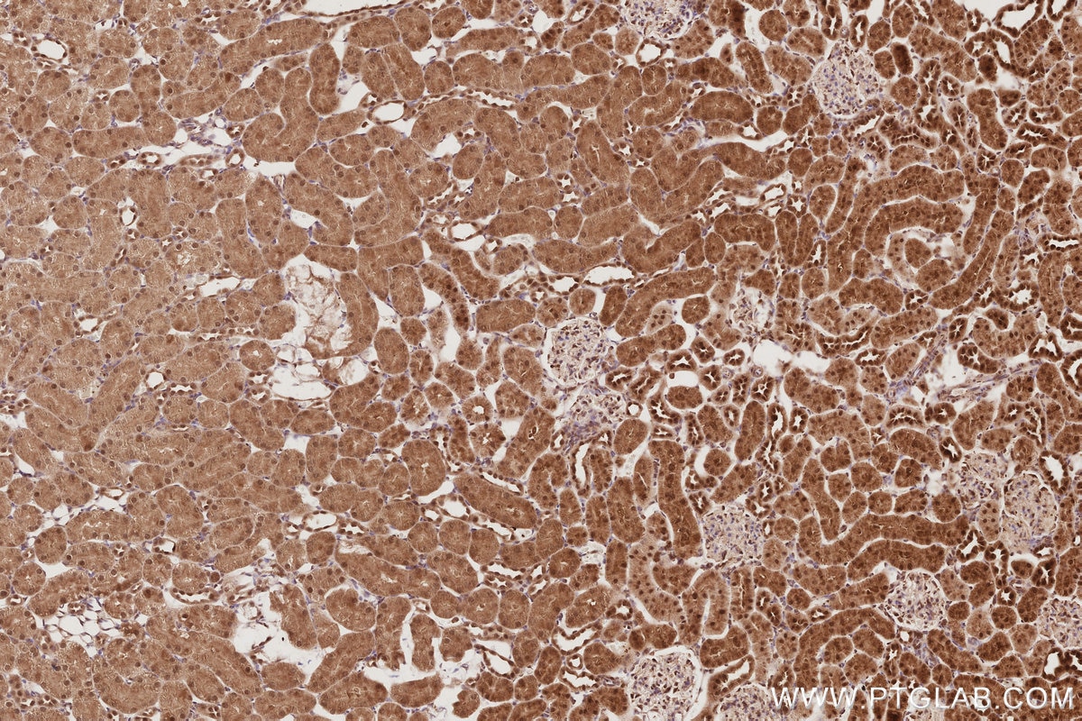 Immunohistochemistry (IHC) staining of rat kidney tissue using APC1 Polyclonal antibody (21748-1-AP)