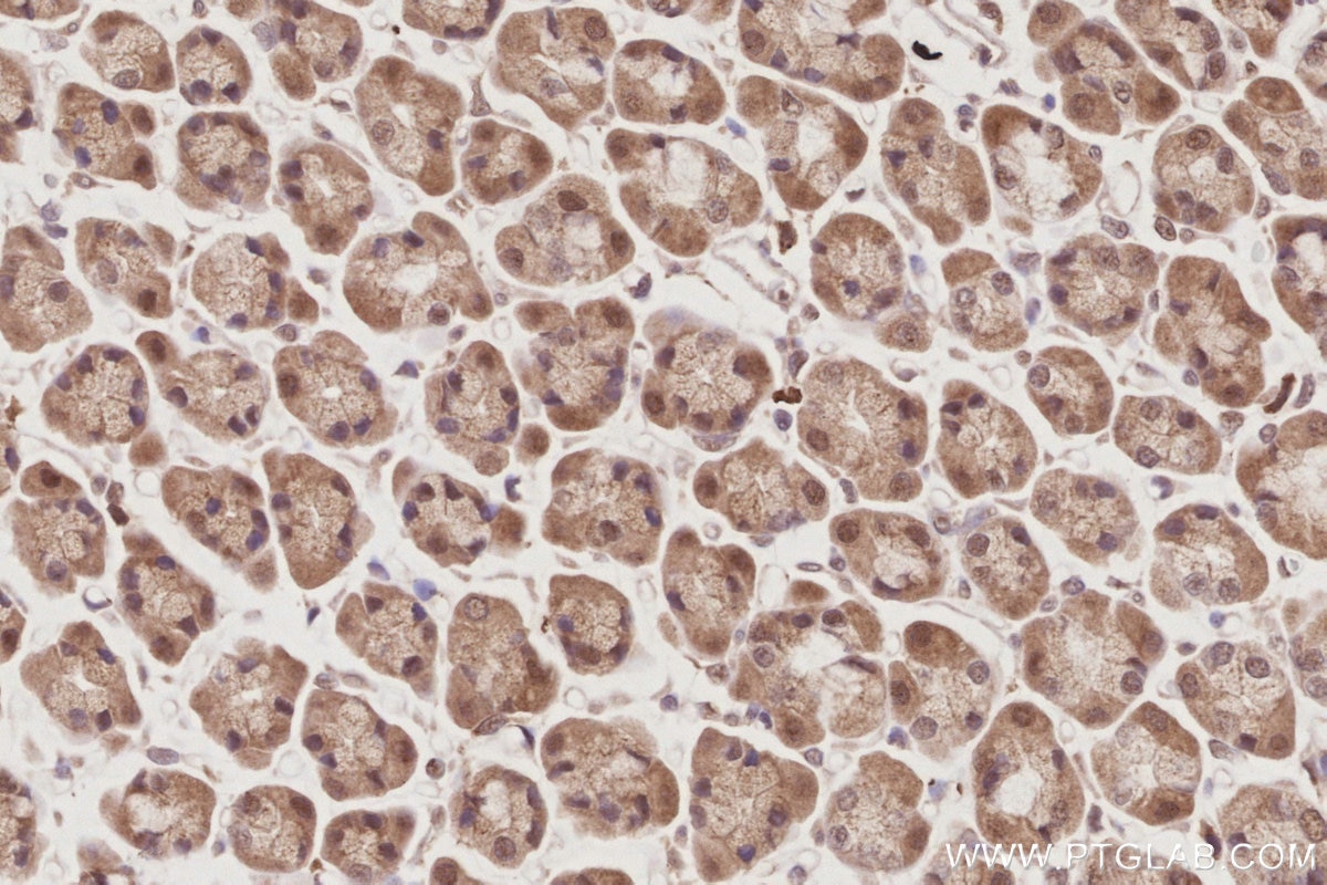 Immunohistochemistry (IHC) staining of rat stomach tissue using APC1 Polyclonal antibody (21748-1-AP)