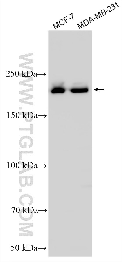 Western Blot (WB) analysis of various lysates using APC1 Polyclonal antibody (21748-1-AP)