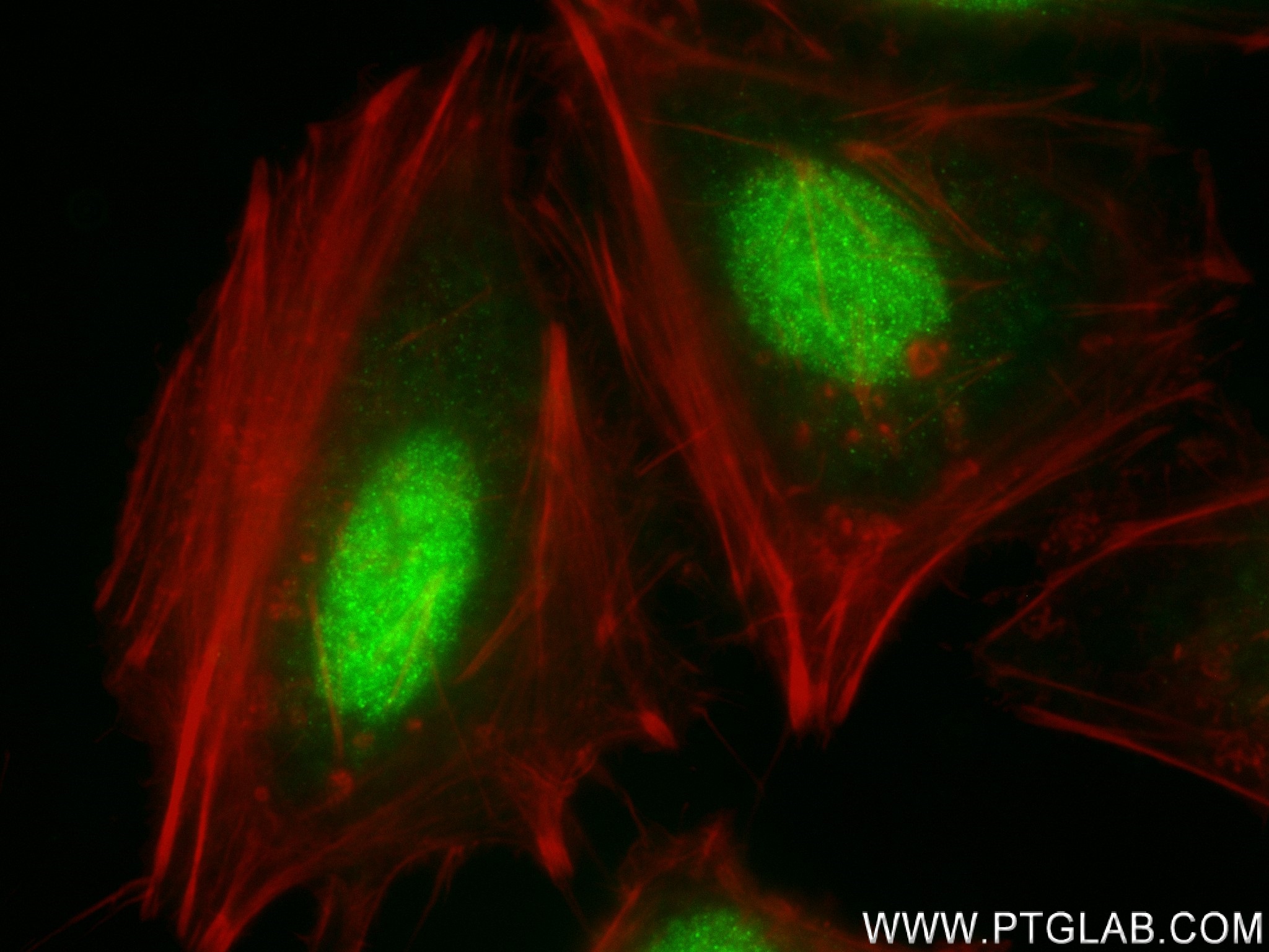 Immunofluorescence (IF) / fluorescent staining of HeLa cells using ANAPC10 Recombinant antibody (83570-4-RR)