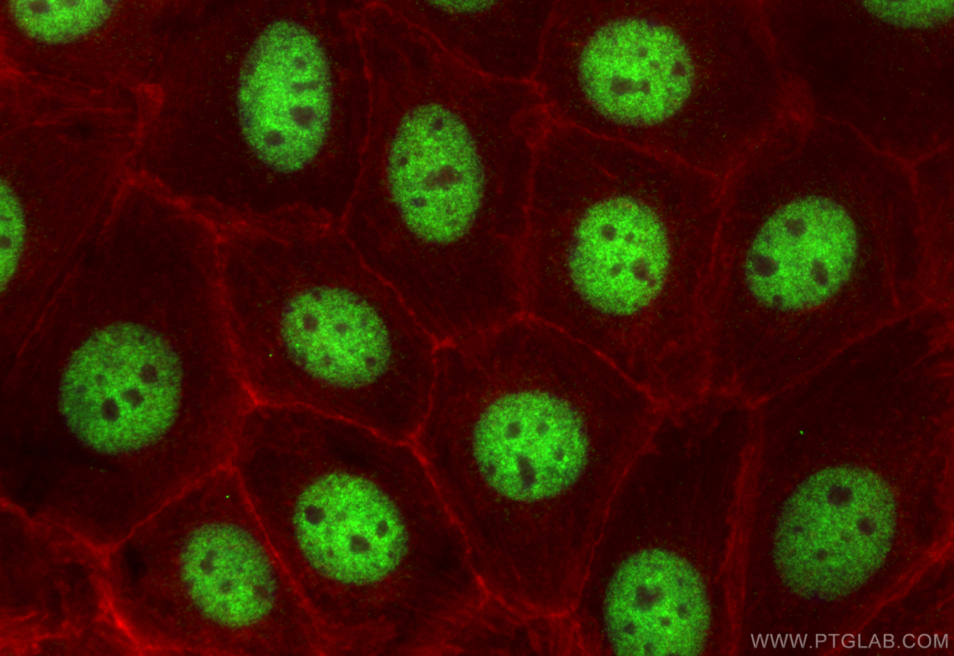 Immunofluorescence (IF) / fluorescent staining of MCF-7 cells using APC2 Polyclonal antibody (13559-1-AP)