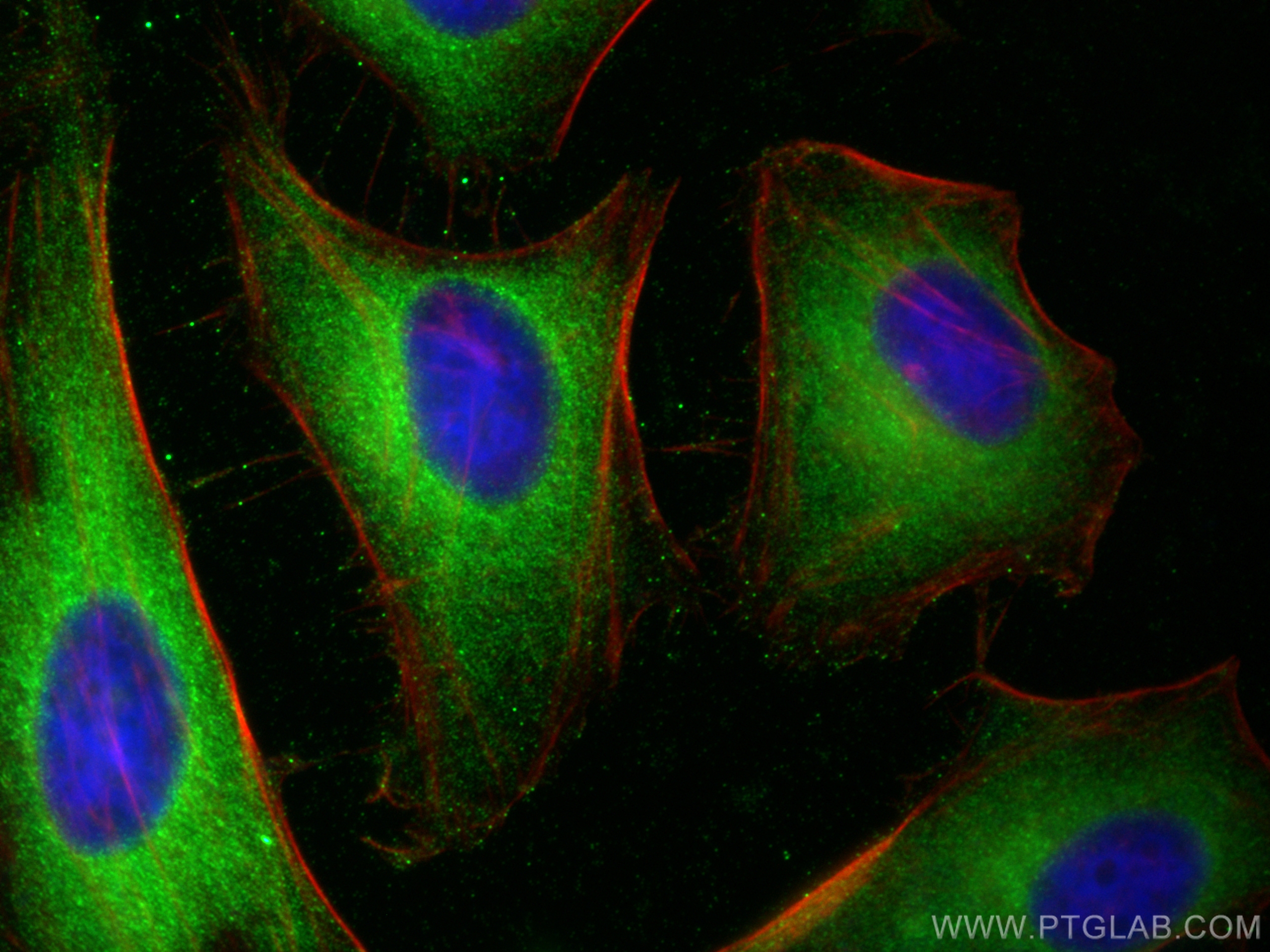 Immunofluorescence (IF) / fluorescent staining of HeLa cells using Angiopoietin 1 Polyclonal antibody (23302-1-AP)