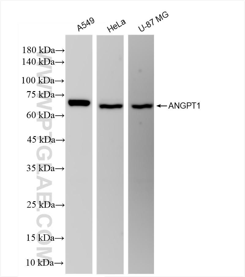 Western Blot (WB) analysis of various lysates using ANGPT1 Recombinant antibody (81990-4-RR)