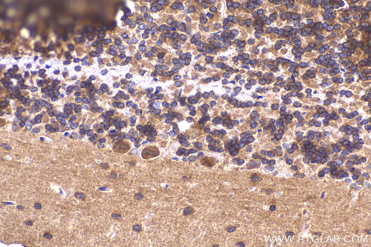 Immunohistochemistry (IHC) staining of rat cerebellum tissue using ANK1 Polyclonal antibody (23938-1-AP)