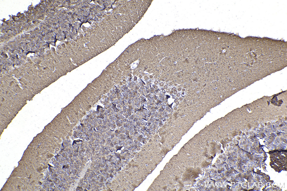 Immunohistochemistry (IHC) staining of mouse cerebellum tissue using ANK1 Polyclonal antibody (23938-1-AP)