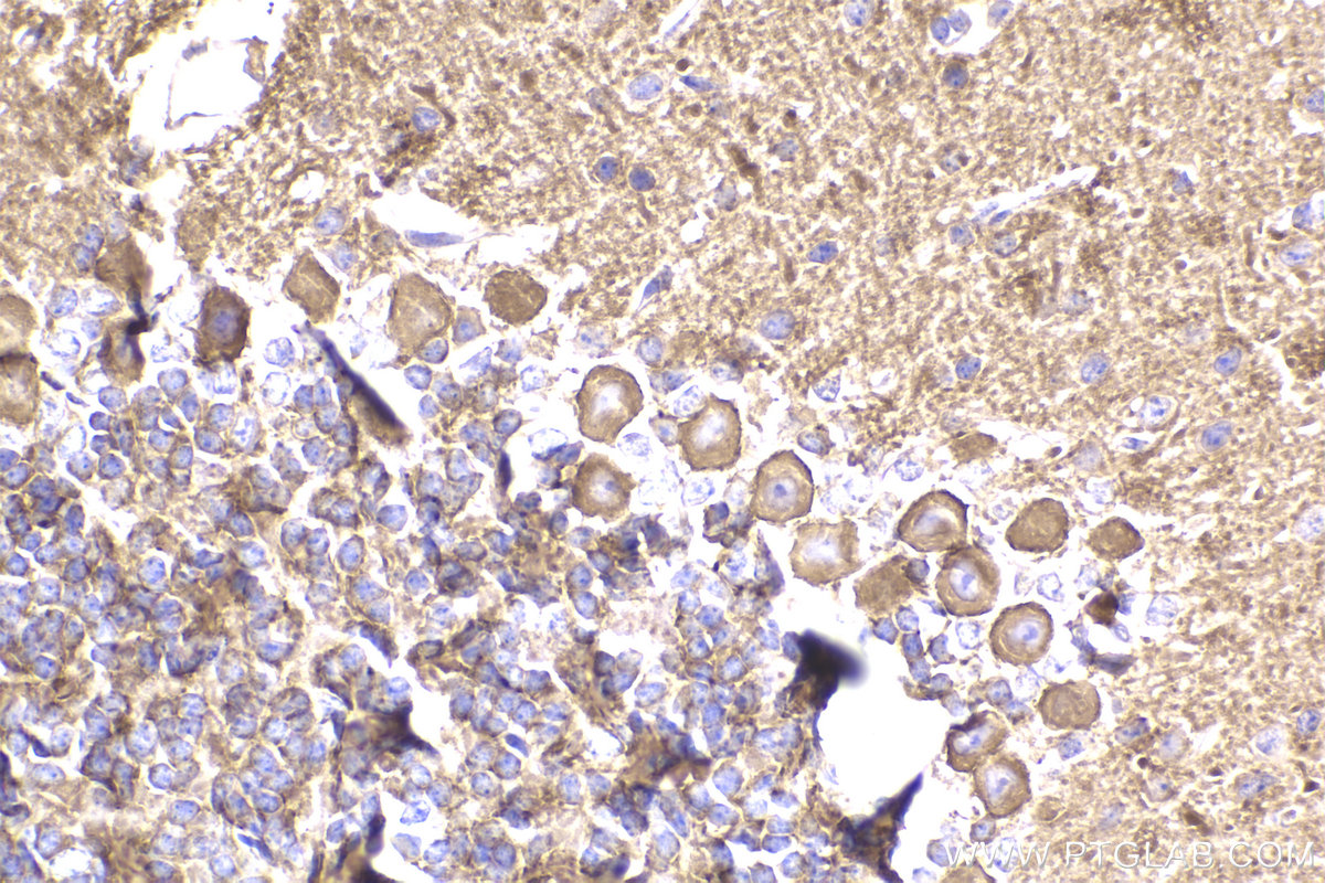 Immunohistochemistry (IHC) staining of mouse cerebellum tissue using ANK1 Polyclonal antibody (23938-1-AP)