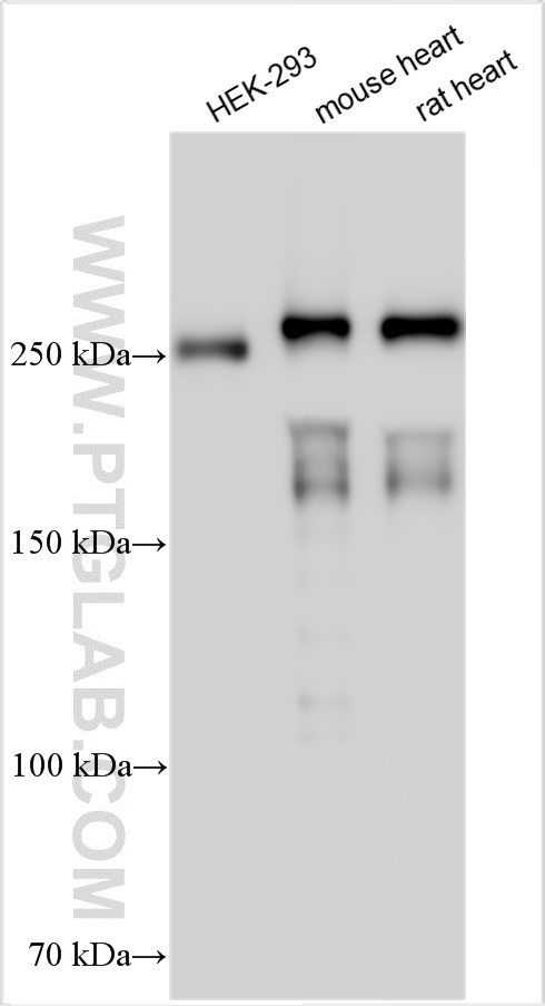 Western Blot (WB) analysis of various lysates using ANK2 Polyclonal antibody (31080-1-AP)