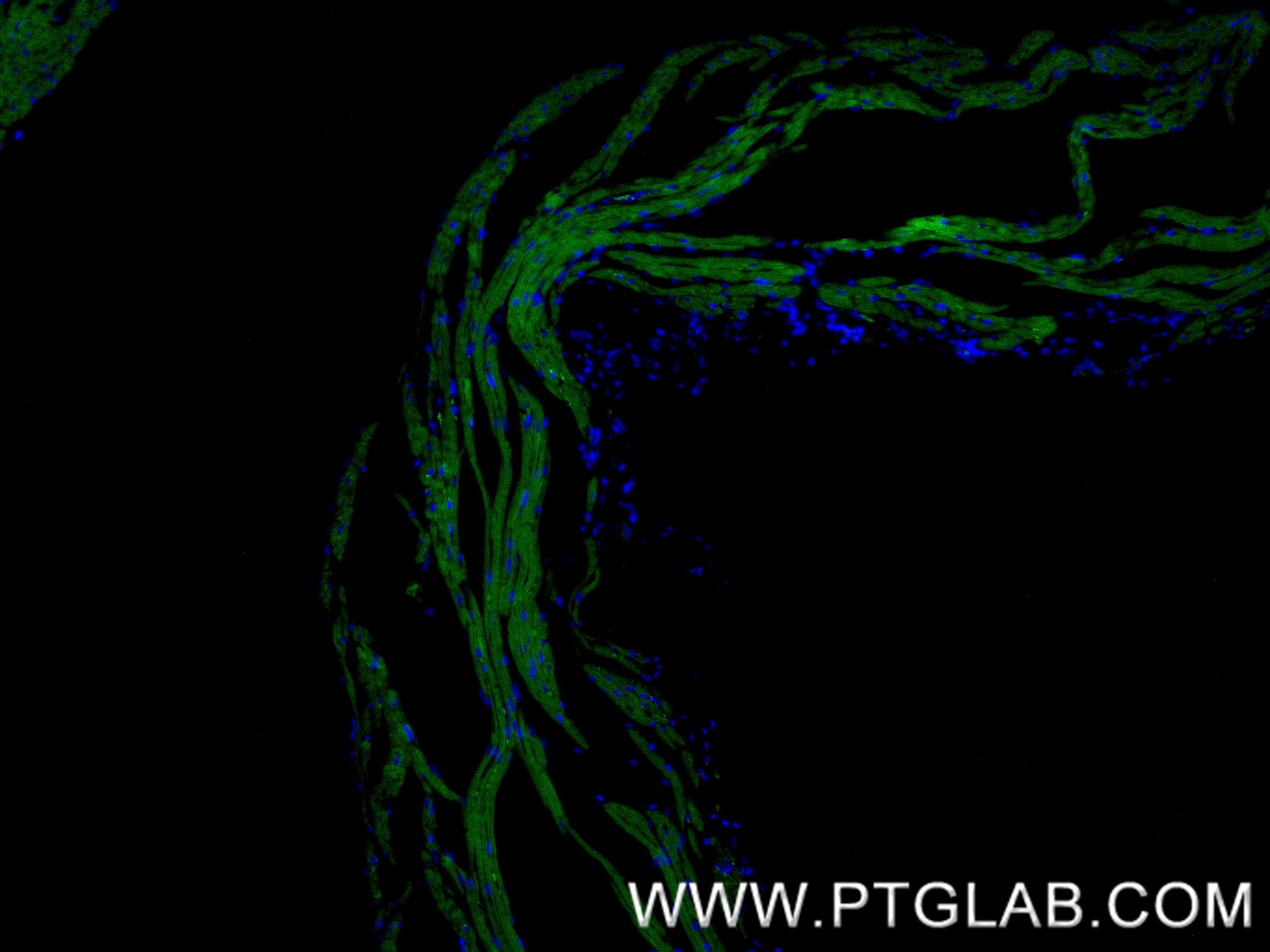 Immunofluorescence (IF) / fluorescent staining of mouse heart tissue using ANK2 Recombinant antibody (83912-5-RR)