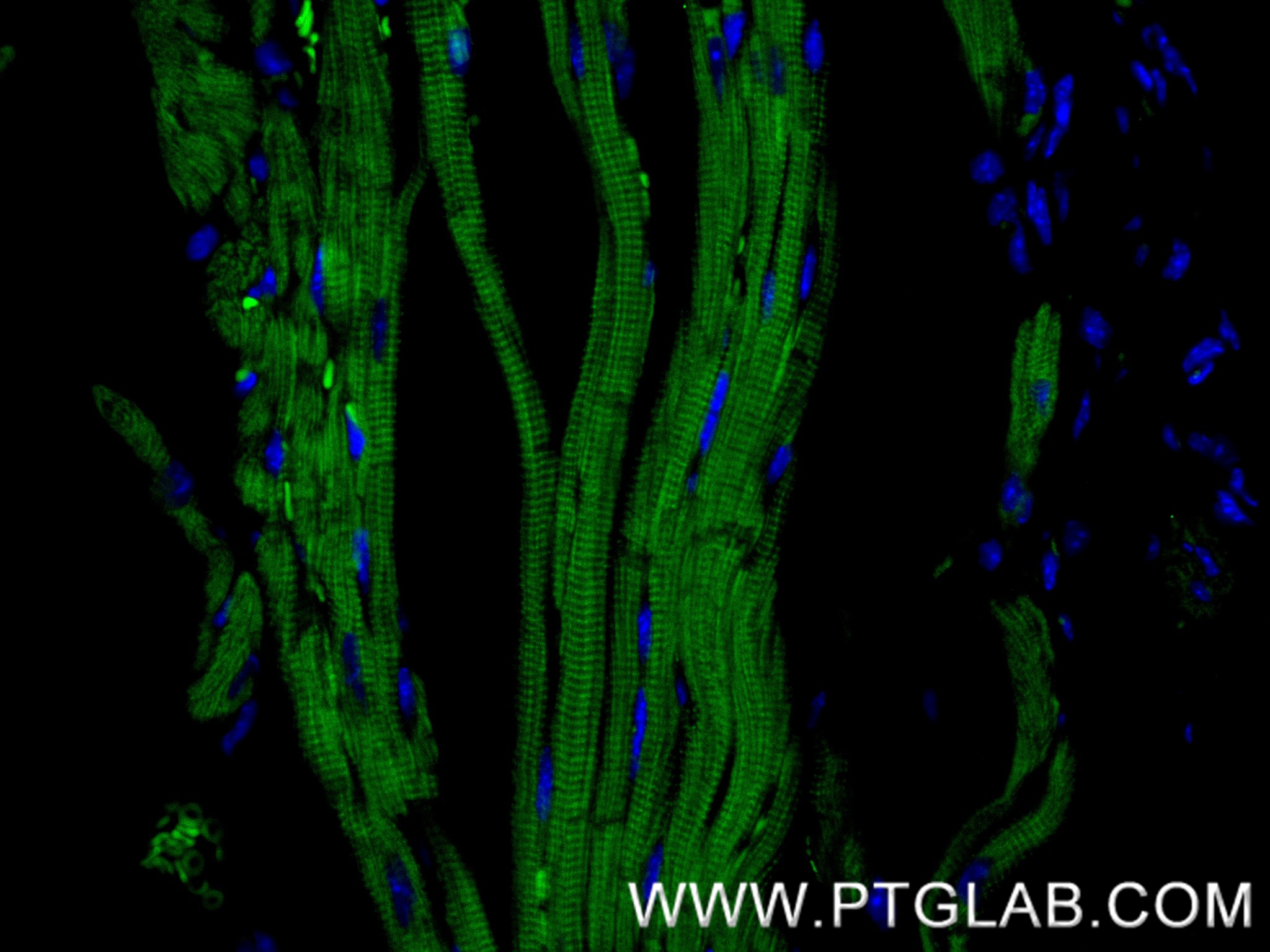 Immunofluorescence (IF) / fluorescent staining of mouse heart tissue using ANK2 Recombinant antibody (83912-5-RR)