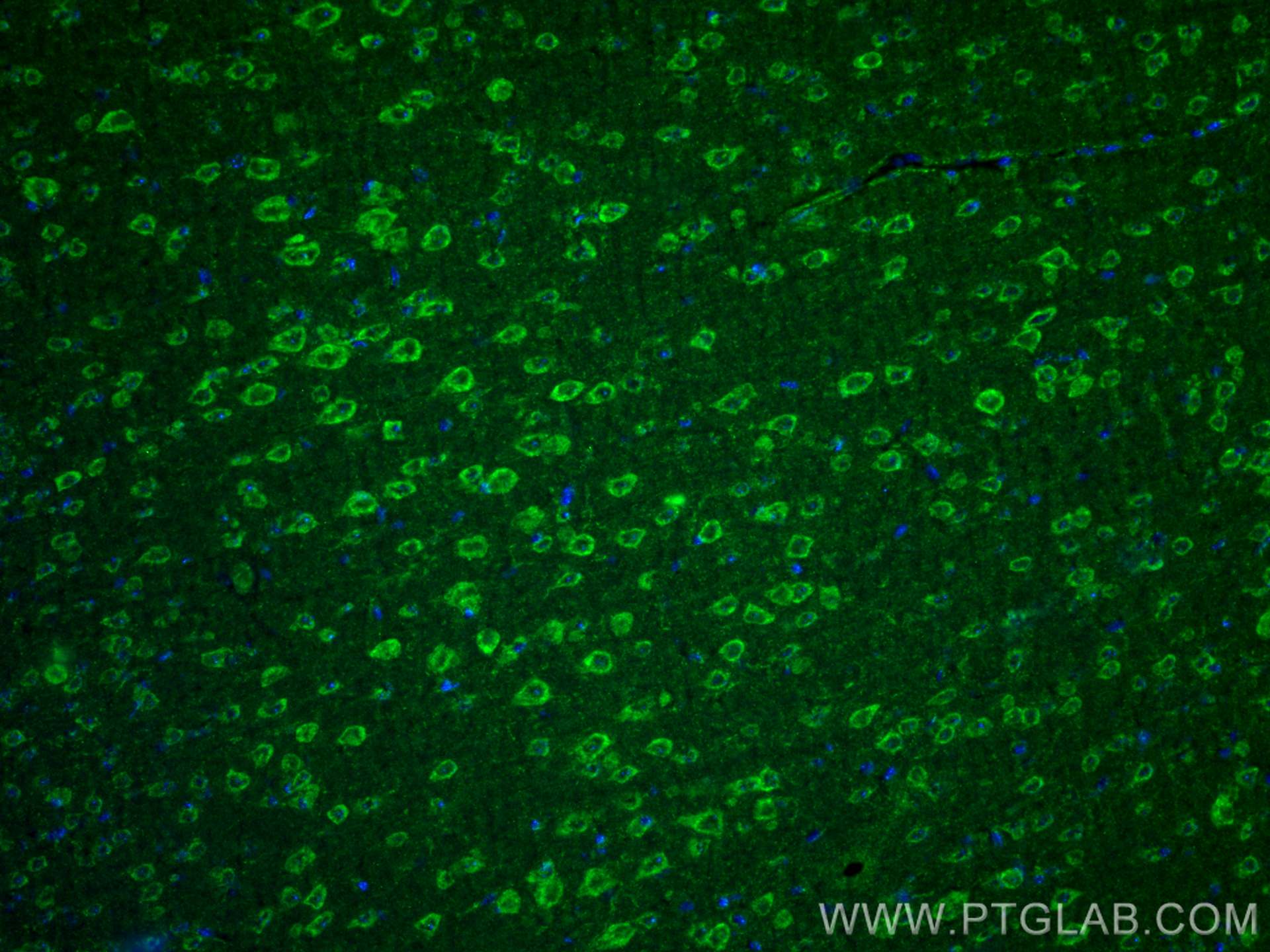 Immunofluorescence (IF) / fluorescent staining of mouse brain tissue using ANK3 Polyclonal antibody (27766-1-AP)