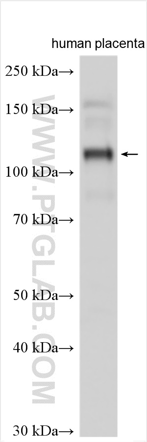 Western Blot (WB) analysis of various lysates using ANKFY1 Polyclonal antibody (24890-1-AP)