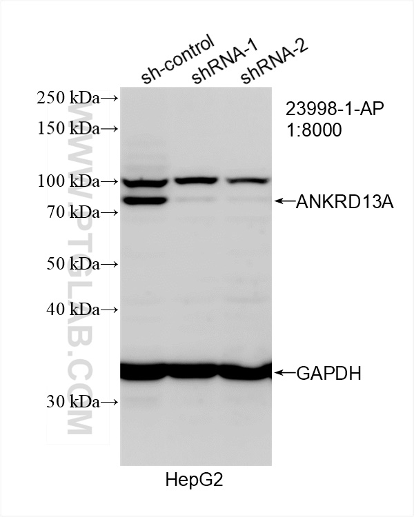 Western Blot (WB) analysis of HepG2 cells using ANKRD13A Polyclonal antibody (23998-1-AP)