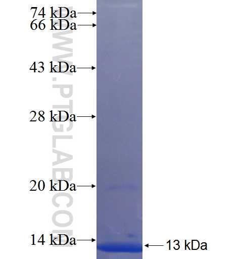 ANKRD13B fusion protein Ag22725 SDS-PAGE