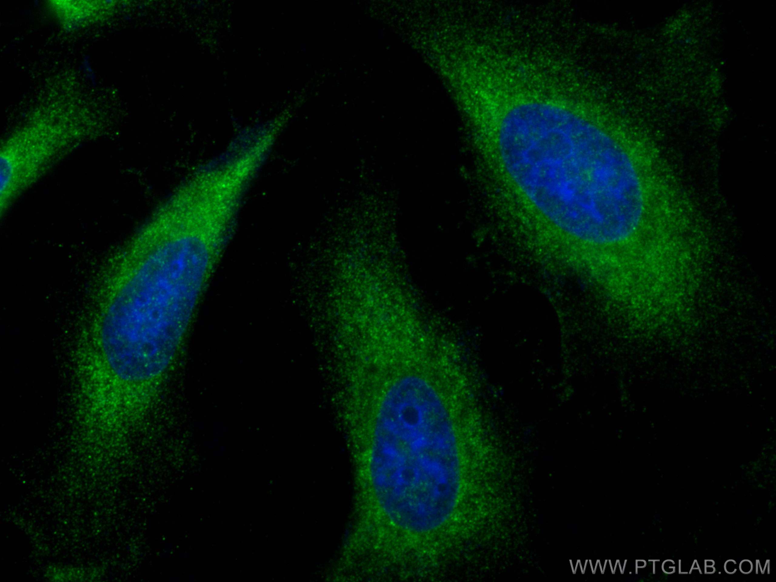 Immunofluorescence (IF) / fluorescent staining of HeLa cells using ANKRD16 Polyclonal antibody (24334-1-AP)