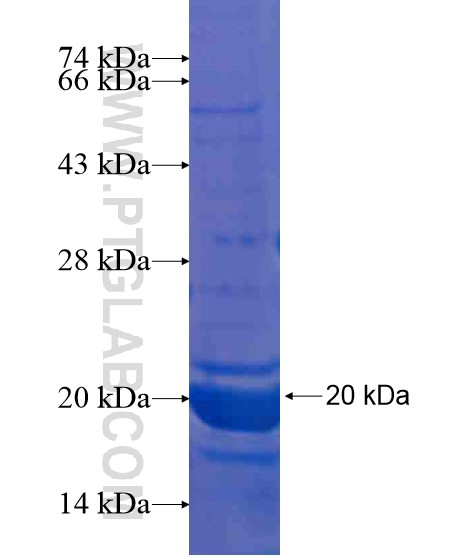 ANKRD18A fusion protein Ag21335 SDS-PAGE