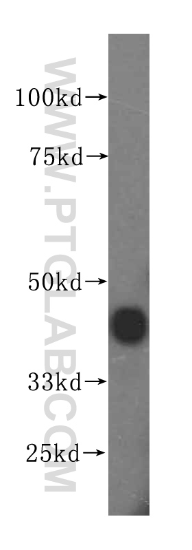 Ошибка avf 11821 программа splice