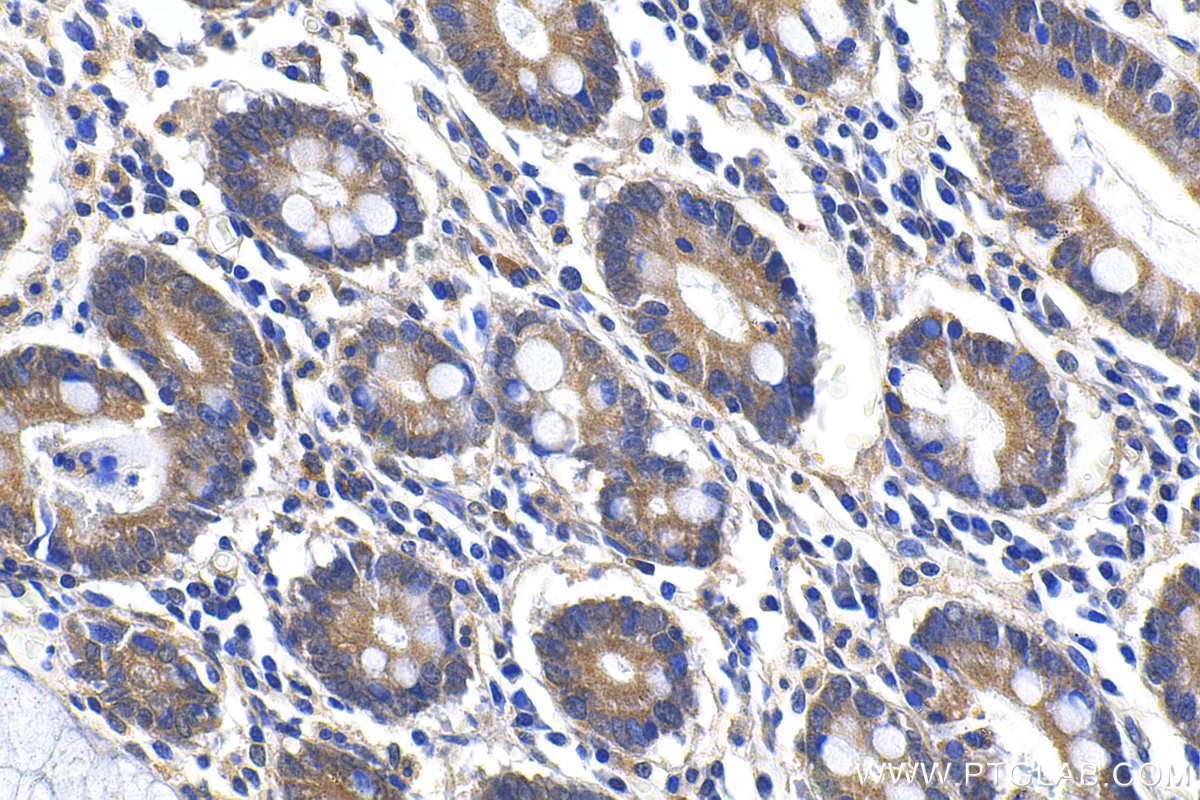 Immunohistochemistry (IHC) staining of human stomach tissue using ANKRD22 Polyclonal antibody (24035-1-AP)