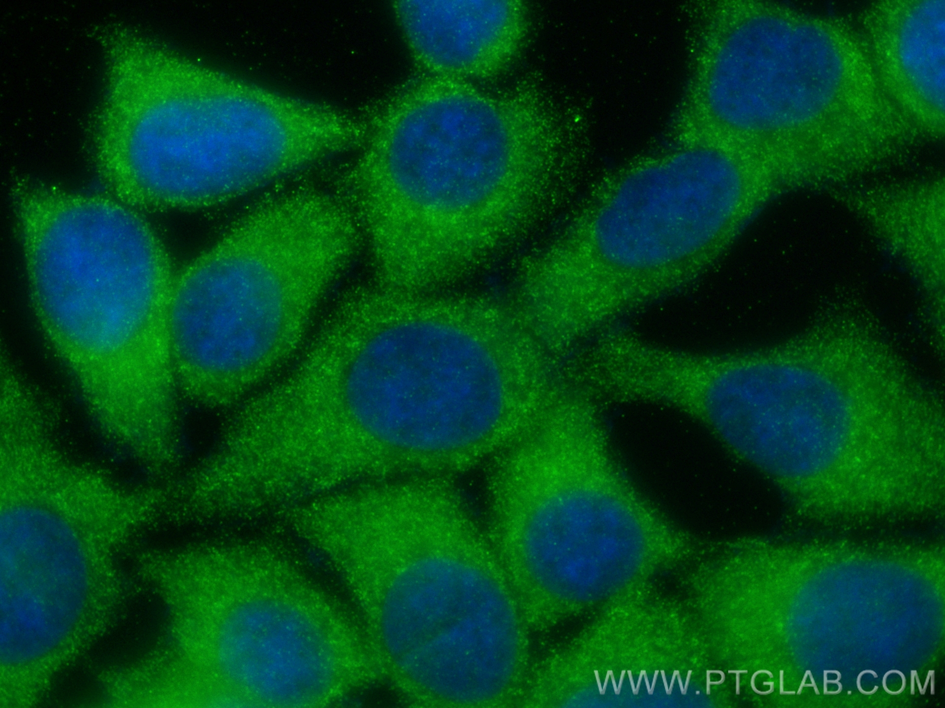 Immunofluorescence (IF) / fluorescent staining of MCF-7 cells using ANKRD27 Polyclonal antibody (24034-1-AP)