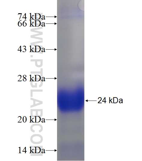 ANKRD37 fusion protein Ag23653 SDS-PAGE