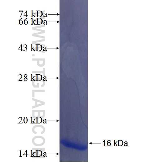 ANKRD40 fusion protein Ag22724 SDS-PAGE