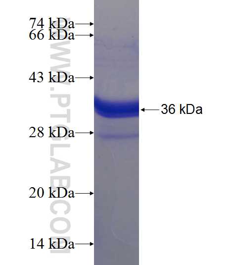 ANKRD40 fusion protein Ag22731 SDS-PAGE