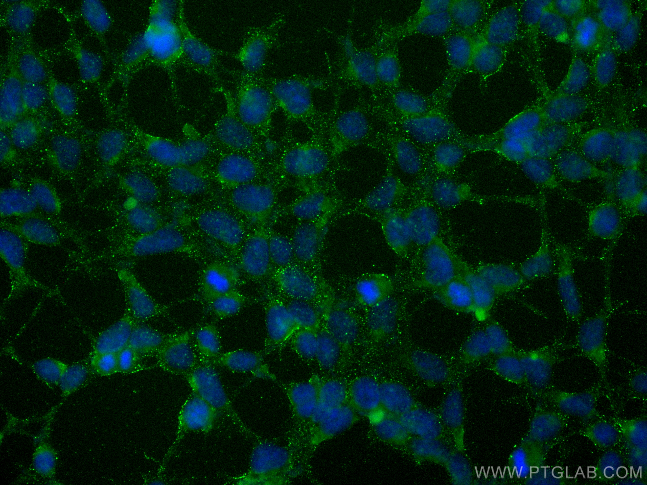 Immunofluorescence (IF) / fluorescent staining of HEK-293 cells using ANKRD46 Polyclonal antibody (27568-1-AP)