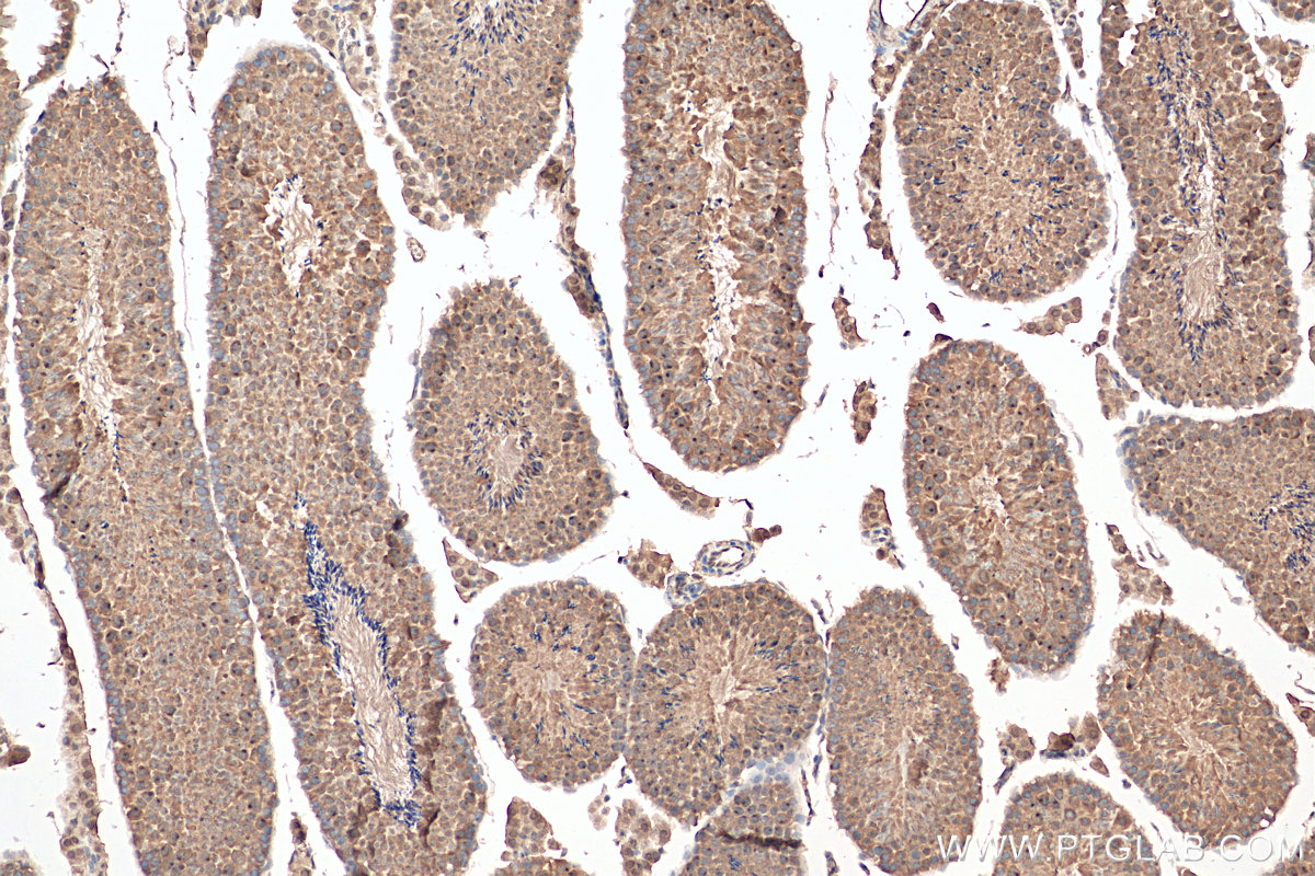 Immunohistochemistry (IHC) staining of mouse testis tissue using ANKRD54 Polyclonal antibody (25738-1-AP)