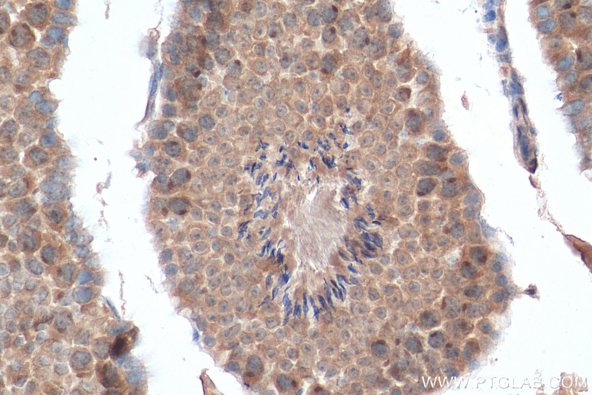 Immunohistochemistry (IHC) staining of mouse testis tissue using ANKRD54 Polyclonal antibody (25738-1-AP)