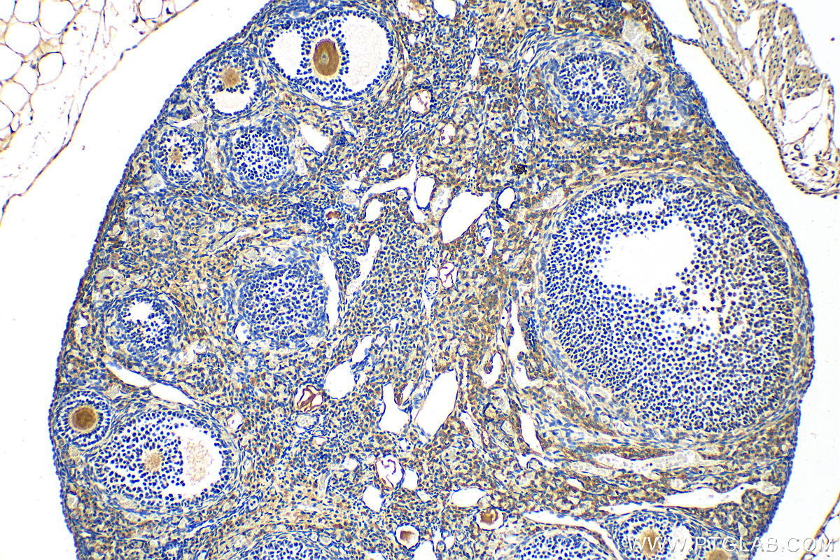 Immunohistochemistry (IHC) staining of mouse ovary tissue using ANKRD6 Polyclonal antibody (24333-1-AP)