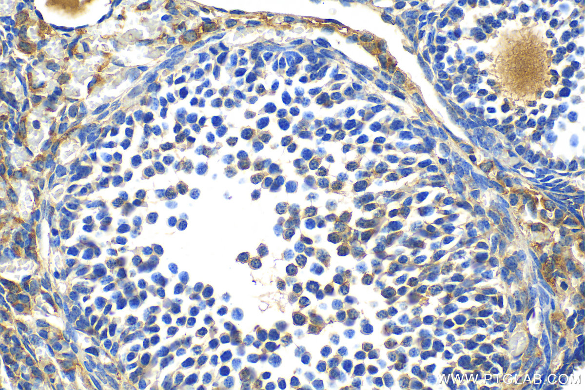 Immunohistochemistry (IHC) staining of mouse ovary tissue using ANKRD6 Polyclonal antibody (24333-1-AP)