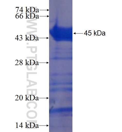 ANKS6 fusion protein Ag22771 SDS-PAGE