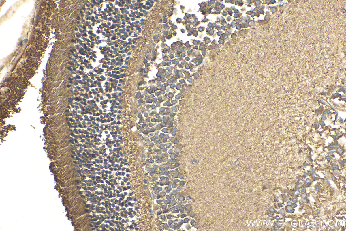 Immunohistochemistry (IHC) staining of mouse eye tissue using ANO2 Polyclonal antibody (20647-1-AP)