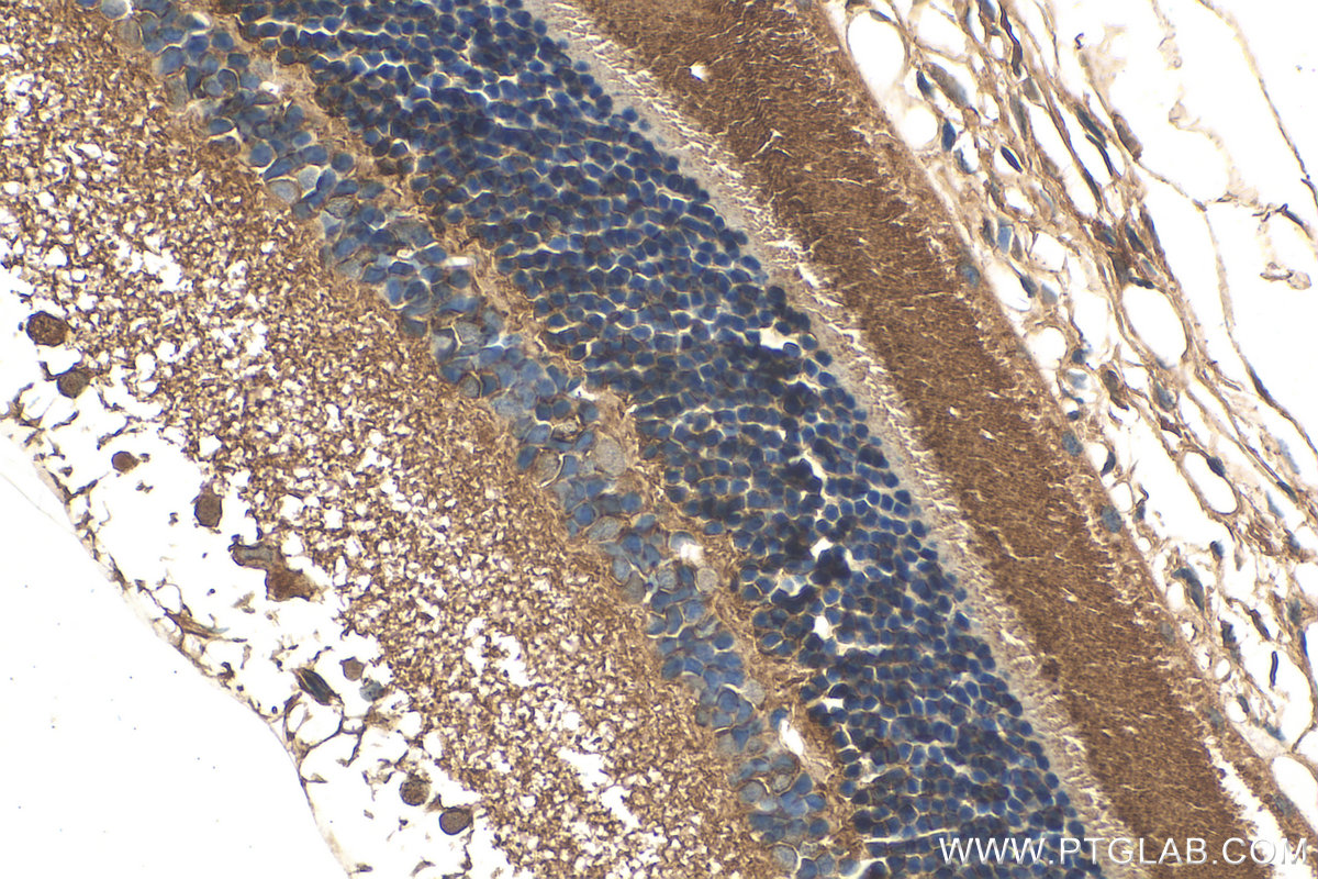 Immunohistochemistry (IHC) staining of rat eye tissue using ANO2 Polyclonal antibody (20647-1-AP)