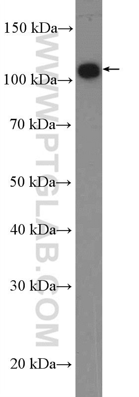 Western Blot (WB) analysis of HEK-293 cells using ANO7 Polyclonal antibody (19486-1-AP)