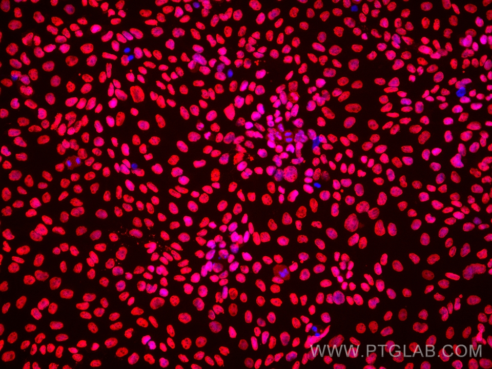 Immunofluorescence (IF) / fluorescent staining of A431 cells using ANP32B Monoclonal antibody (66160-1-Ig)