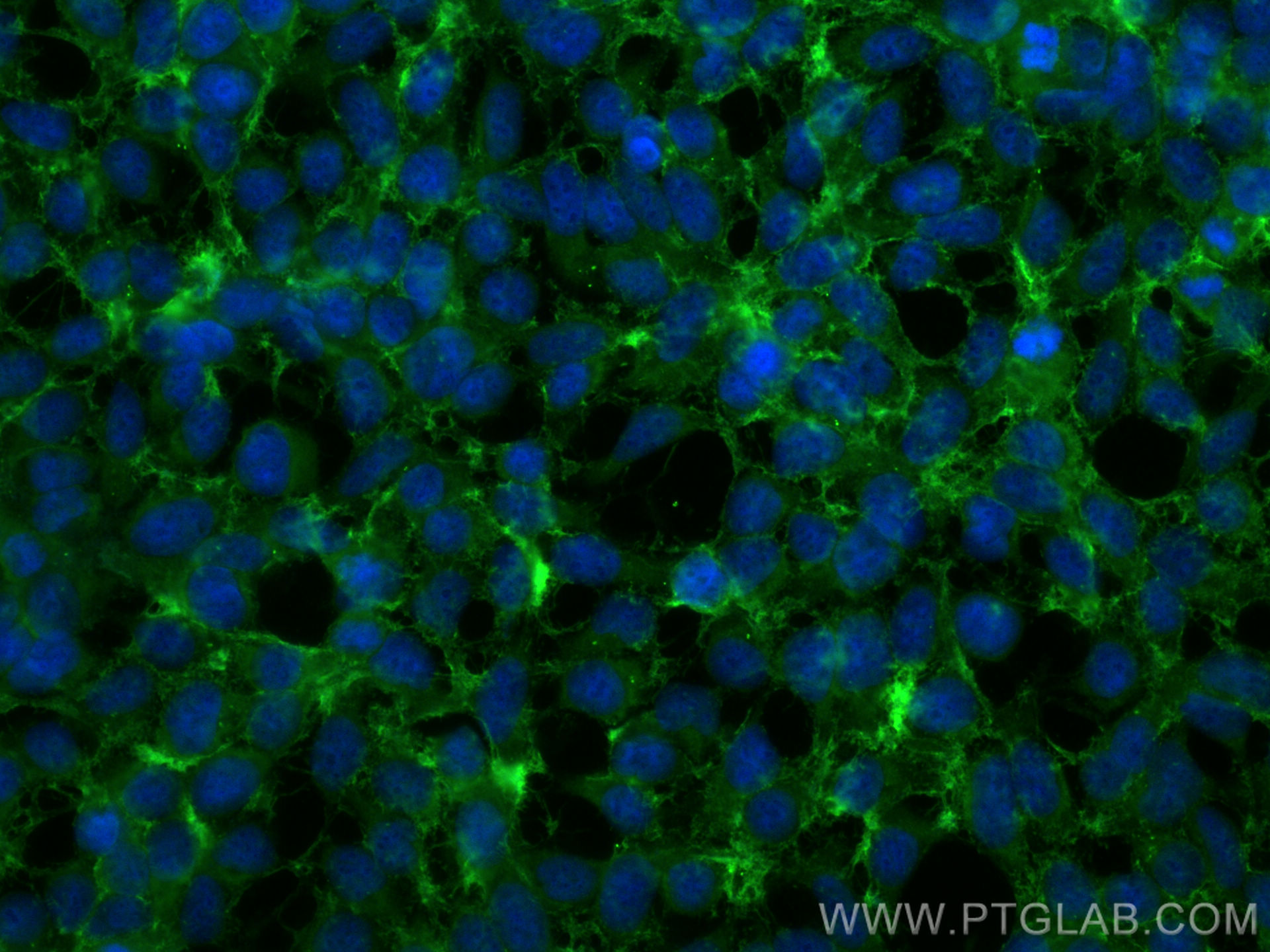 Immunofluorescence (IF) / fluorescent staining of HEK-293 cells using CD13 Polyclonal antibody (14553-1-AP)